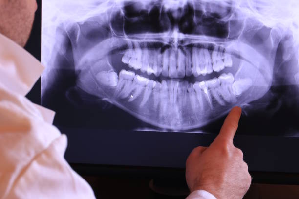 Best Emergency Treatment for Toothache in Harrison, WI